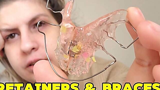 RETAINERS CLOSE UP